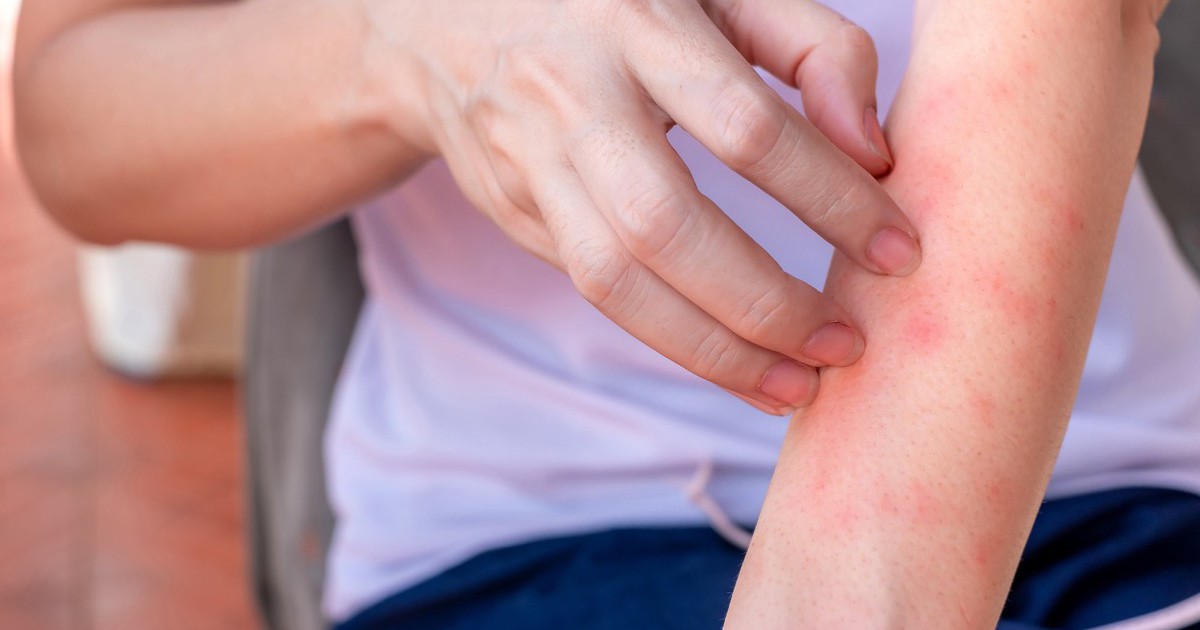 Nếu bạn có hai vùng da bị ngứa dai dẳng trên cơ thể, hãy cảnh giác vì đó có thể là dấu hiệu của ung thư gan