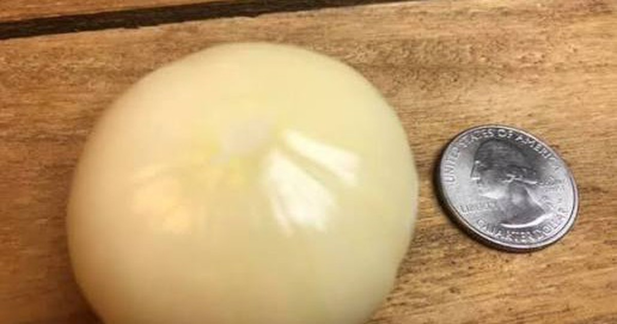 Trồng tỏi gần 1 năm, người đàn ông 67 tuổi đào lên rồi sững sờ: Một kỷ lục thế giới mới được xác lập!