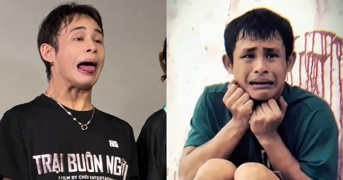 Chàng trai mắc hội chứng lạ gây sốt trong phim "Trại buôn người"