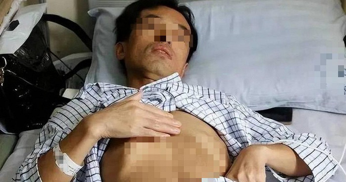 Người đàn ông 53 tuổi nhận "án tử" ung thư gan, bác sĩ tức giận: Đừng làm việc này quá 3 lần 1 tháng!