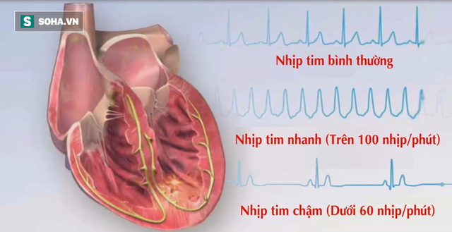 Các chuyên gia sức khỏe khẳng định người có nhịp tim chậm sẽ sống thọ. (Ảnh minh họa).