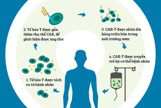 Tóm tắt phác đồ điều trị ung thư bằng liệu pháp CAR-T