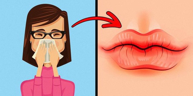 8 dấu hiệu của đôi môi cần đặc biệt chú ý vì sức khoẻ của bạn đang gặp vấn đề - Ảnh 2.