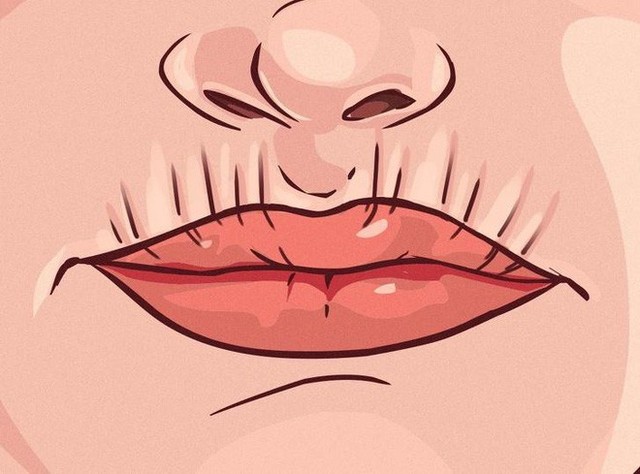 8 dấu hiệu của đôi môi cần đặc biệt chú ý vì sức khoẻ của bạn đang gặp vấn đề - Ảnh 5.