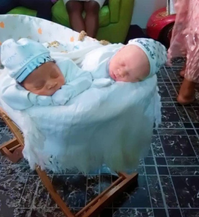 Cặp sinh đôi chào đời cách nhau vài phút nhưng khiến bác sĩ cũng sốc, cả bệnh viện kéo đến chụp ảnh - Ảnh 2.