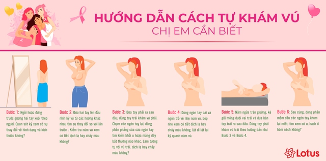 Ung thư vú đang ngày càng trẻ hoá: Bác sĩ chuyên khoa khẳng định có thể chữa khỏi hoàn toàn, không tái phát nếu được phát hiện sớm - Ảnh 2.