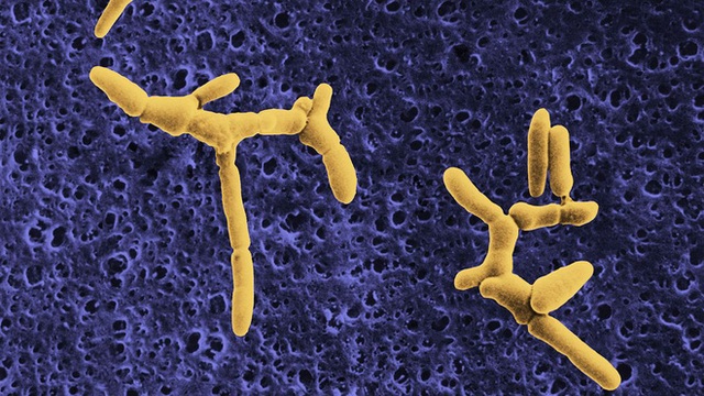 Bùng phát nhiễm khuẩn listeria gây chết người tại Mỹ: Nghi xuất phát từ món ăn vô cùng quen thuộc - Ảnh 1.