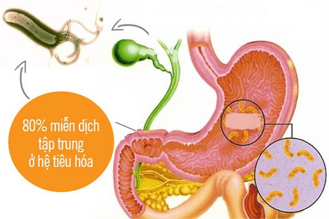  28 tuổi bị ung thư dạ dày giai đoạn cuối, BS khẩn thiết: Người trẻ đừng mắc sai lầm này - Ảnh 1.