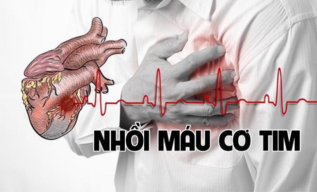 Đang lái xe thì gặp cơn đau như cá nằm trên thớt: 2 việc cần làm ngay khi thấy người bị nhồi máu cơ tim - Ảnh 2.