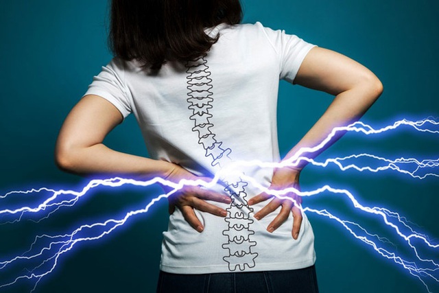  Đau lưng có thể là triệu chứng của 4 bệnh lý cần chú ý - Ảnh 1.