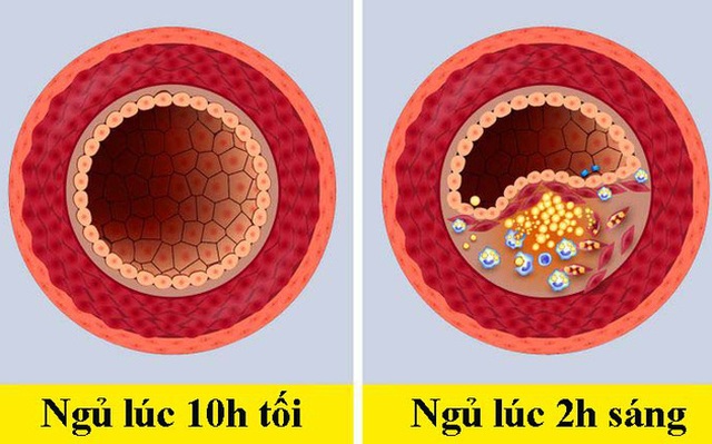 Khi đi ngủ trước - sau 10h tối, cơ thể con người sẽ khác nhau như thế nào?