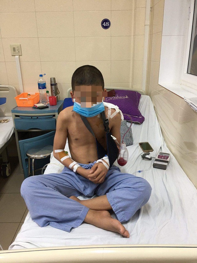 Lần đầu tiên ở Việt Nam: Phẫu thuật thay xương bả vai cho bệnh nhi nhỏ tuổi nhất - Ảnh 2.