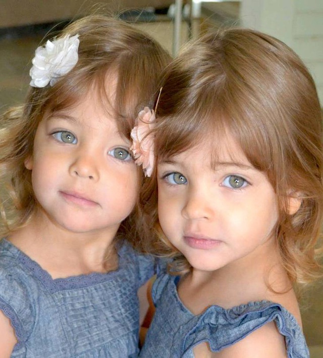 How have the 6-month-old twins who received an advertising contract changed in appearance after 10 years of being named the most beautiful in the world?  - Photo 3.