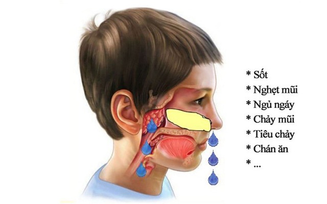 Sự thật về nạo VA gây suy giảm miễn dịch cho trẻ: Chuyên gia nói gì?