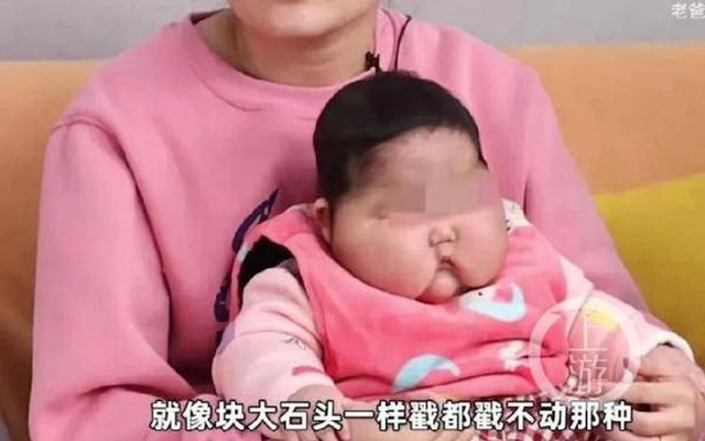 Trung Quốc thu hồi loại kem khiến trẻ sơ sinh tăng cân bất thường