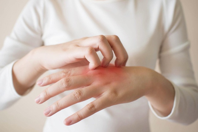 Thường xuyên bị tê mỏi tay, hãy cảnh giác vì nó có thể là dấu hiệu của 5 căn bệnh nguy hiểm này - Ảnh 2.