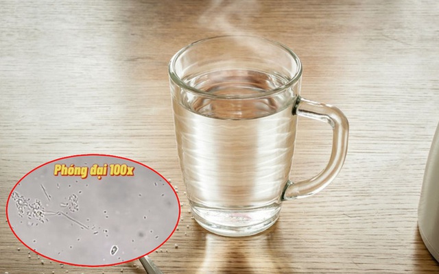 SỰ THẬT rùng mình về nước sôi để nguội khi soi dưới kính hiển vi và 3 loại nước lọc không nên uống để tránh nhiễm độc, mắc ung thư