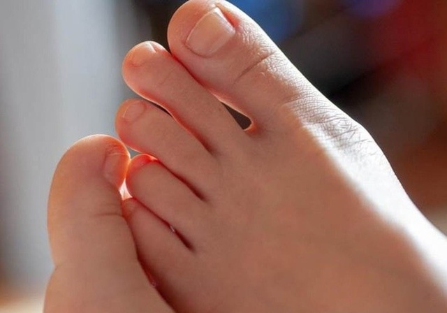 Nam giới có thận khỏe thường có 3 biểu hiện đặc trưng ở bàn chân, mong rằng bạn hội tụ tất cả - Ảnh 1.