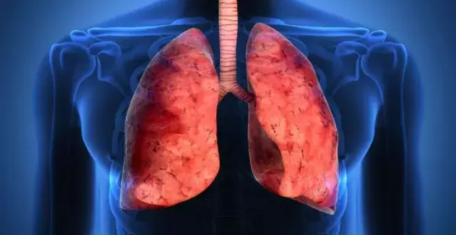 Người đàn ông 47 tuổi được chẩn đoán bị ung thư phổi: Bác sĩ cảnh báo nếu cơ thể xuất hiện 1 dày, 2 đen, 3 đau này thì phải đi khám ngay kẻo phổi nát, cái chết gần kề - Ảnh 1.