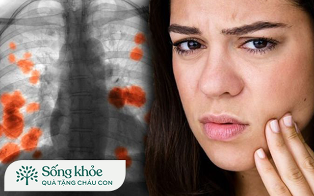 3 dấu hiệu trên gương mặt cảnh báo phổi tổn thương: Từ bỏ ngay 4 thói quen này nếu không muốn phổi nát tươm