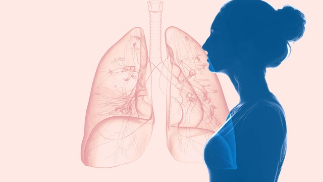 80% bệnh nhân nữ mắc ung thư phổi không hề hút thuốc: Chuyên gia lý giải nguyên do là 4 yếu tố này, trong đó 1 thứ có trong bếp mọi gia đình - Ảnh 1.