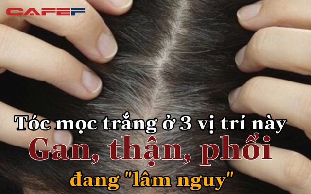 Tổng hợp những khúc mắc của người tiêu dùng về bonihair chữa bạc tóc và  giải đáp | websosanh.vn