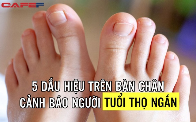 5 dấu hiệu tuổi thọ ngắn nhìn thấy rõ rệt ngay trên bàn chân: Nếu ai có đủ thì cần thay đổi lối sống ngay từ bây giờ