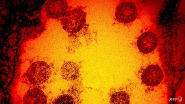 Vì sao biến chủng của virus SARS-CoV-2 xuất hiện ngày càng nhiều và qua mặt hệ miễn dịch? - Ảnh 3.