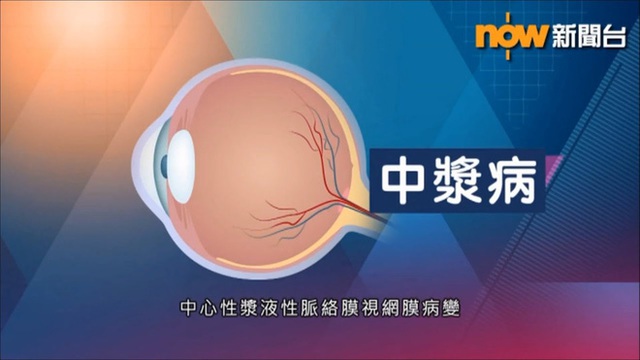 BS nhãn khoa: Người trẻ sử dụng điện thoại, máy tính nhiều có thể mắc bệnh mắt vĩnh viễn - Ảnh 4.