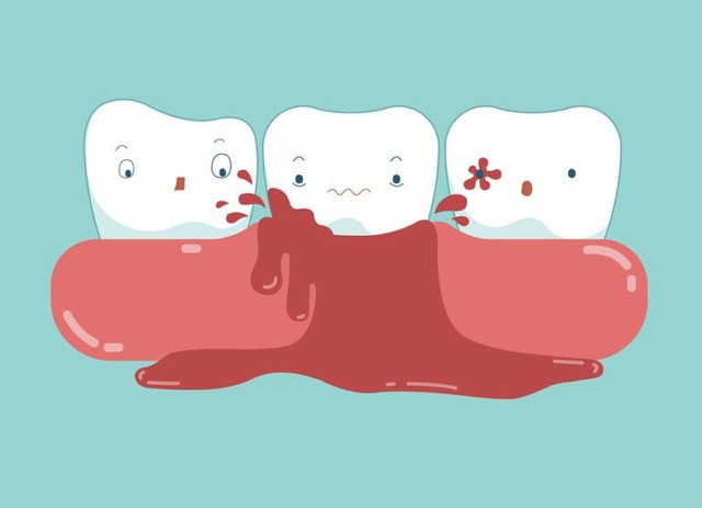 5 tín hiệu mà cơ thể muốn chúng ta biết khi bị thiếu chất trầm trọng: Nếu xuất hiện tình trạng sau, có thể bạn cần xem xét lại bữa ăn của mình - Ảnh 1. 5 tín hiệu mà cơ thể muốn chúng ta biết khi bị thiếu chất trầm trọng: Nếu xuất hiện tình trạng sau, có thể bạn cần xem xét lại bữa ăn của mình - Ảnh 1.