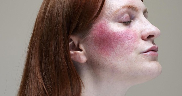 5 tín hiệu mà cơ thể muốn chúng ta biết khi bị thiếu chất trầm trọng: Nếu xuất hiện tình trạng sau, có thể bạn cần xem xét lại bữa ăn của mình - Ảnh 2. 5 tín hiệu mà cơ thể muốn chúng ta biết khi bị thiếu chất trầm trọng: Nếu xuất hiện tình trạng sau, có thể bạn cần xem xét lại bữa ăn của mình - Ảnh 2.