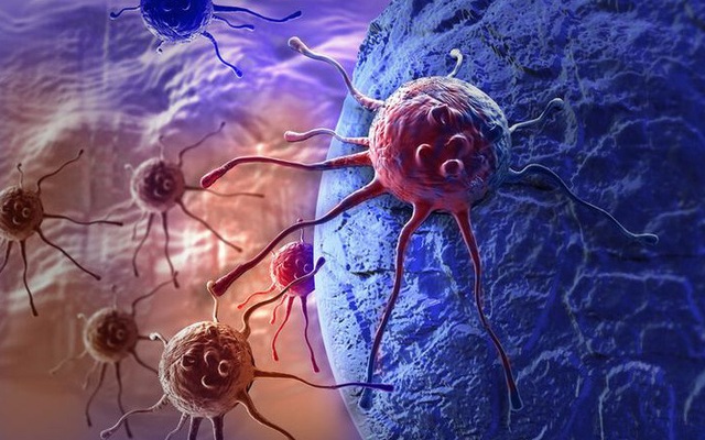 Ai cũng có "tế bào ung thư", chuyên gia kiến nghị 4 bộ mật mã chống ung thư, lợi ích cả đời