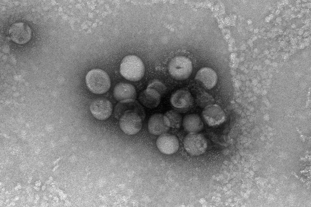 Phát hiện 2 con virus anh em với Covid-19: Quái vật 4 trong 1, nhảy từ động vật sang người - Ảnh 5.