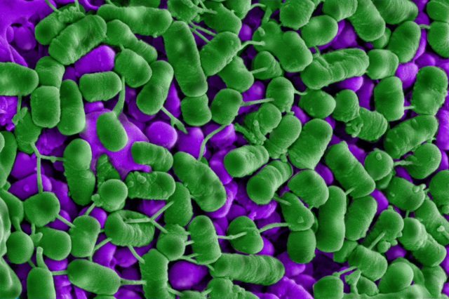 Nghiên cứu từ ĐH RMIT tại Úc: Nem chua Việt Nam chứa hợp chất tự nhiên quý giá giúp diệt khuẩn - Ảnh 1.