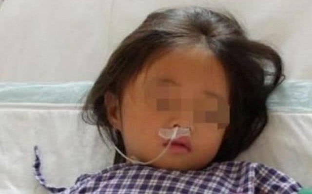 Bé gái 7 tuổi nhập viện trong tình trạng suy đa tạng chỉ vì bố mẹ phạm sai lầm khi chế 1 món nhiều người yêu thích