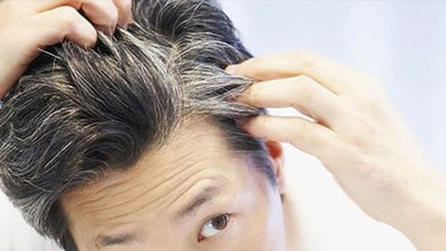 Cẩn thận nếu đầu tóc bạn xuất hiện 6 dấu hiệu này: Bết, thưa, rụng hay bạc sớm không đáng sợ bằng điều này  - Ảnh 1.