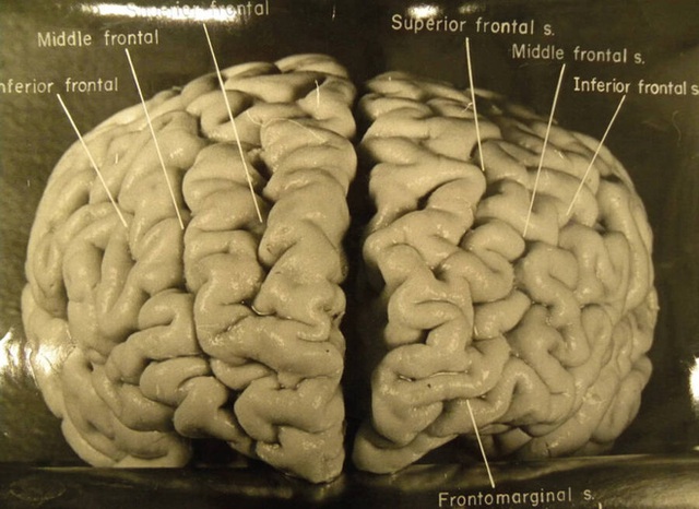  Chuyến phiêu lưu của bộ não Albert Einstein, người có IQ cao nhất thế giới sau khi nó bị đánh cắp khỏi cơ thể  - Ảnh 1.