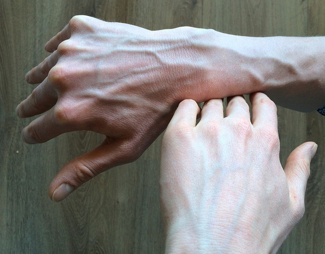 Người có gan kém thường có 4 biểu hiện bất thường ở bàn tay, nếu không có thì gan vẫn rất khỏe mạnh - Ảnh 4.