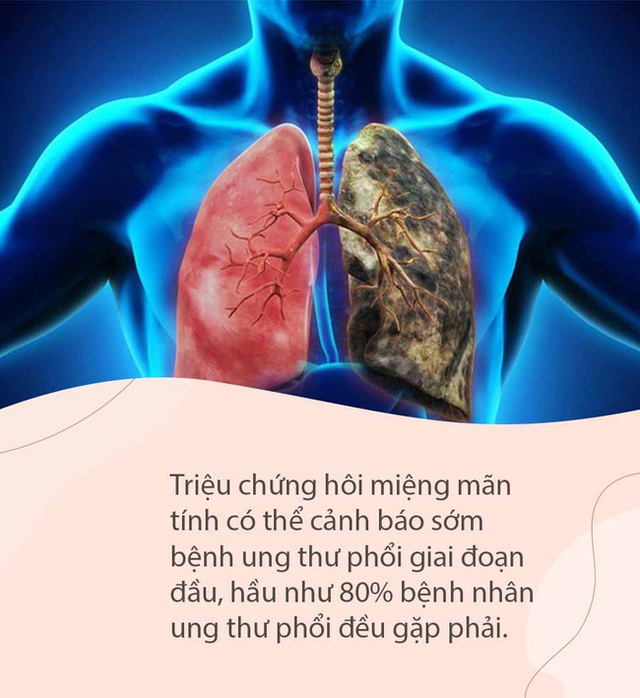 Miệng có mùi đặc biệt này không ung thư thì cũng suy thận, tiểu đường, can thiệp sớm sẽ phòng ngừa các biến chứng nguy hiểm - Ảnh 5.