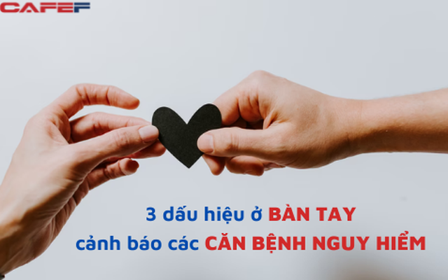 3 dấu hiệu ở bàn tay là lời “cầu cứu” của tim mạch: bác sĩ kiến nghị đi kiểm khám ngay khi tay có 3 biểu hiện sau, nguy cơ nhiều bệnh tật đang “kéo đến”