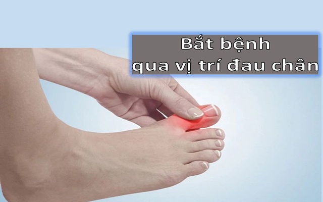 6 vị trí đau chân này là “manh mối” của các loại bệnh khác nhau: Nhẹ thì đau nhức xương khớp do thời tiết, nặng có lẽ bệnh tiểu đường đang đến rất gần, nhất định không được xem nhẹ