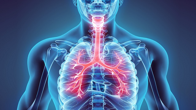 6 dấu hiệu cảnh báo bệnh phổi ai cũng cần biết: Phát hiện sớm có thể cứu sống bạn - Ảnh 2.