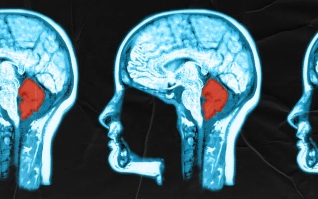 Phát hiện chức năng hoàn toàn mới của tiểu não: 200 năm vẫn khiến nhà khoa học ngạc nhiên!