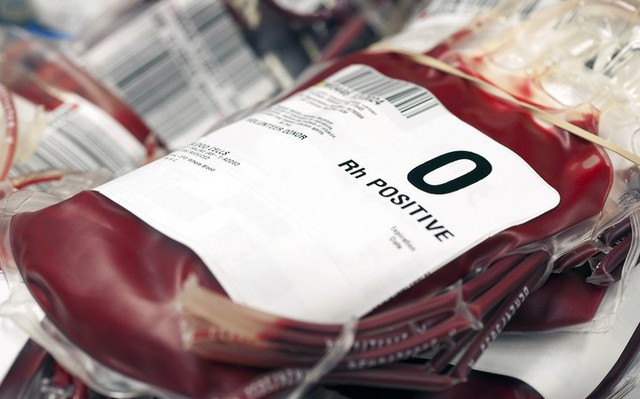 Nghiên cứu hơn 600.000 người: Người nhóm máu O sống thọ nhất, nhóm máu A dễ bị đột quỵ hơn
