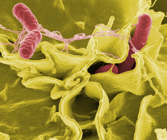 Vi khuẩn Salmonella hay ở trong thực phẩm nào và chúng nguy hại ra sao - Ảnh 1.