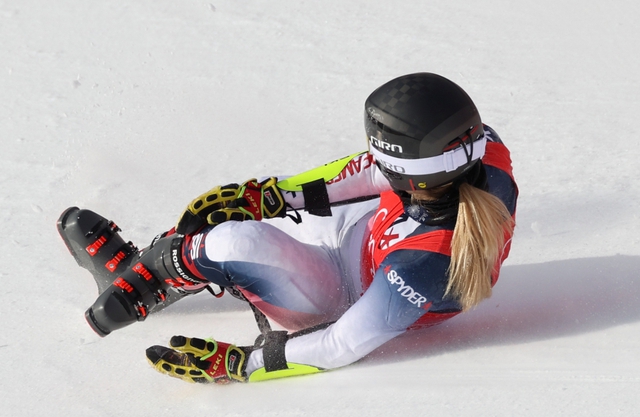 Cổ chân của nữ VĐV trượt tuyết bẻ cong 90 độ sau tai nạn nghiêm trọng ở Olympic - Ảnh 3.