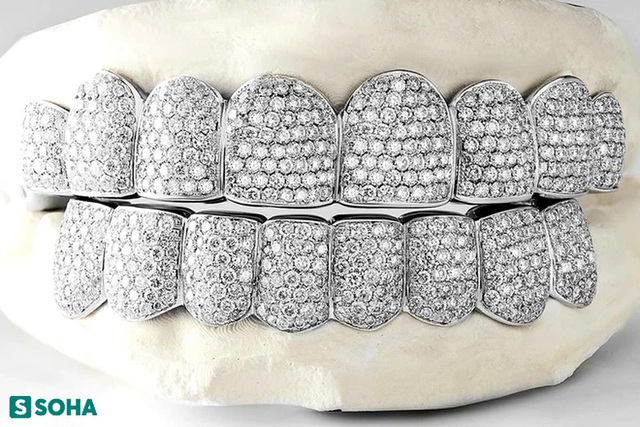 Chàng trai tạo trang sức kim cương cho răng, 400 triệu VNĐ/bộ: Khách hàng toàn người nổi tiếng - Ảnh 13.