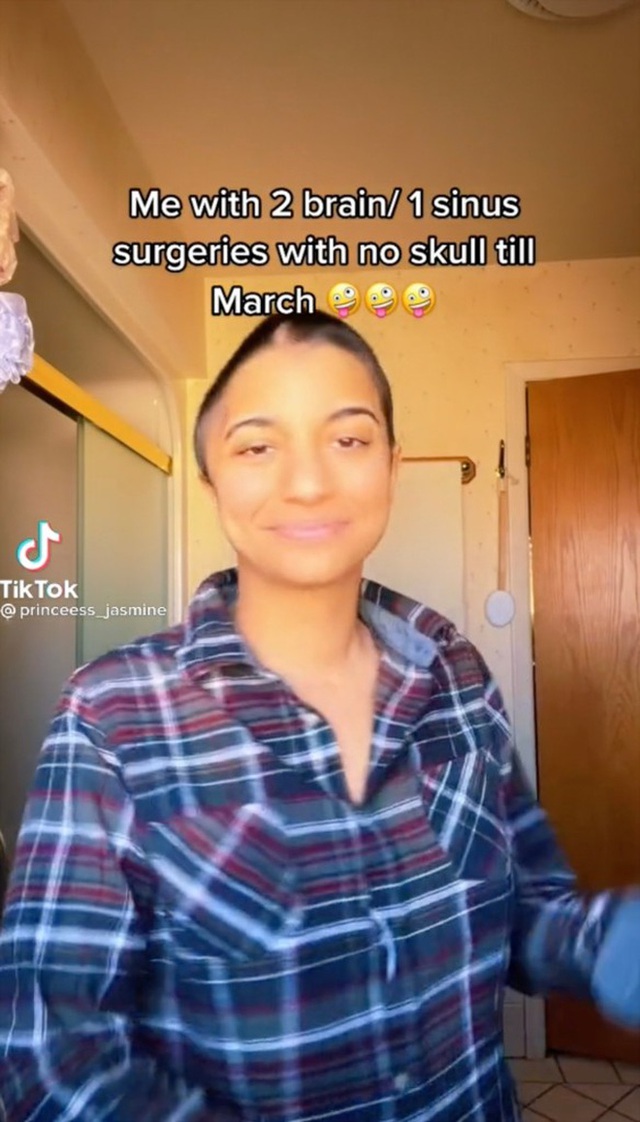  Cô gái 25 tuổi phải cắt nửa hộp sọ, suýt mất mạng chỉ từ một triệu chứng sức khỏe nhỏ ai cũng gặp mà toàn mặc định bỏ qua luôn - Ảnh 5.