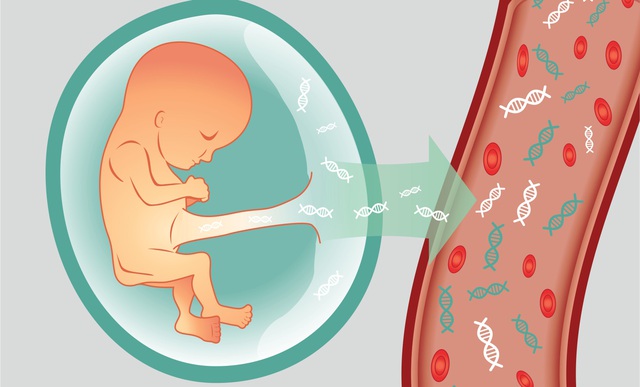 3 yếu tố làm tăng nguy cơ mắc bệnh Down ở thai nhi, ai cũng cần chú ý vì thế hệ tương lai - Ảnh 4.