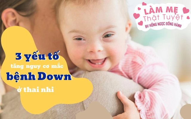 Bệnh Down Ở Thai Nhi: Những Điều Mẹ Bầu Cần Biết